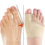 Pack 02 Corrector Juanete