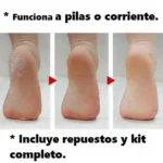 Removedor De Callos