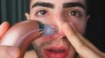 Succionador De Espinillas