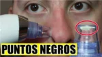 Succionador De Espinillas