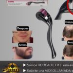 DERMA ROLLER